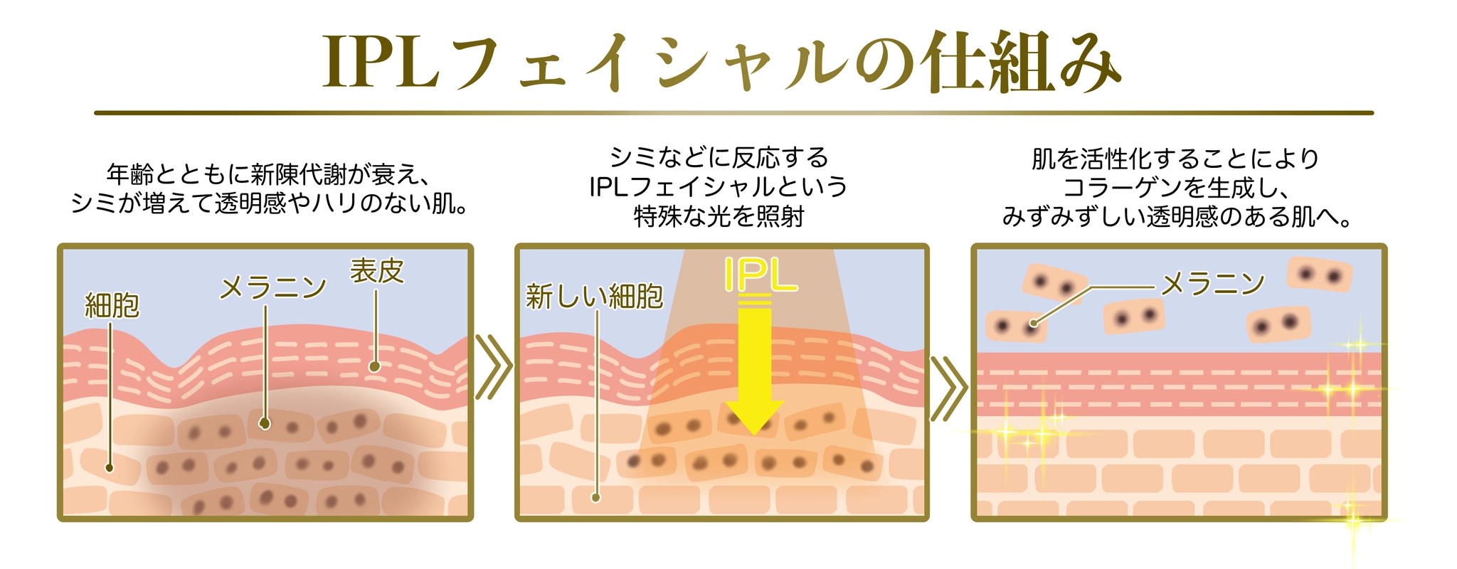 IPLフェイシャルの仕組み図｜やさしい光が肌に届き、明るく透明感のある肌印象へ導く流れ