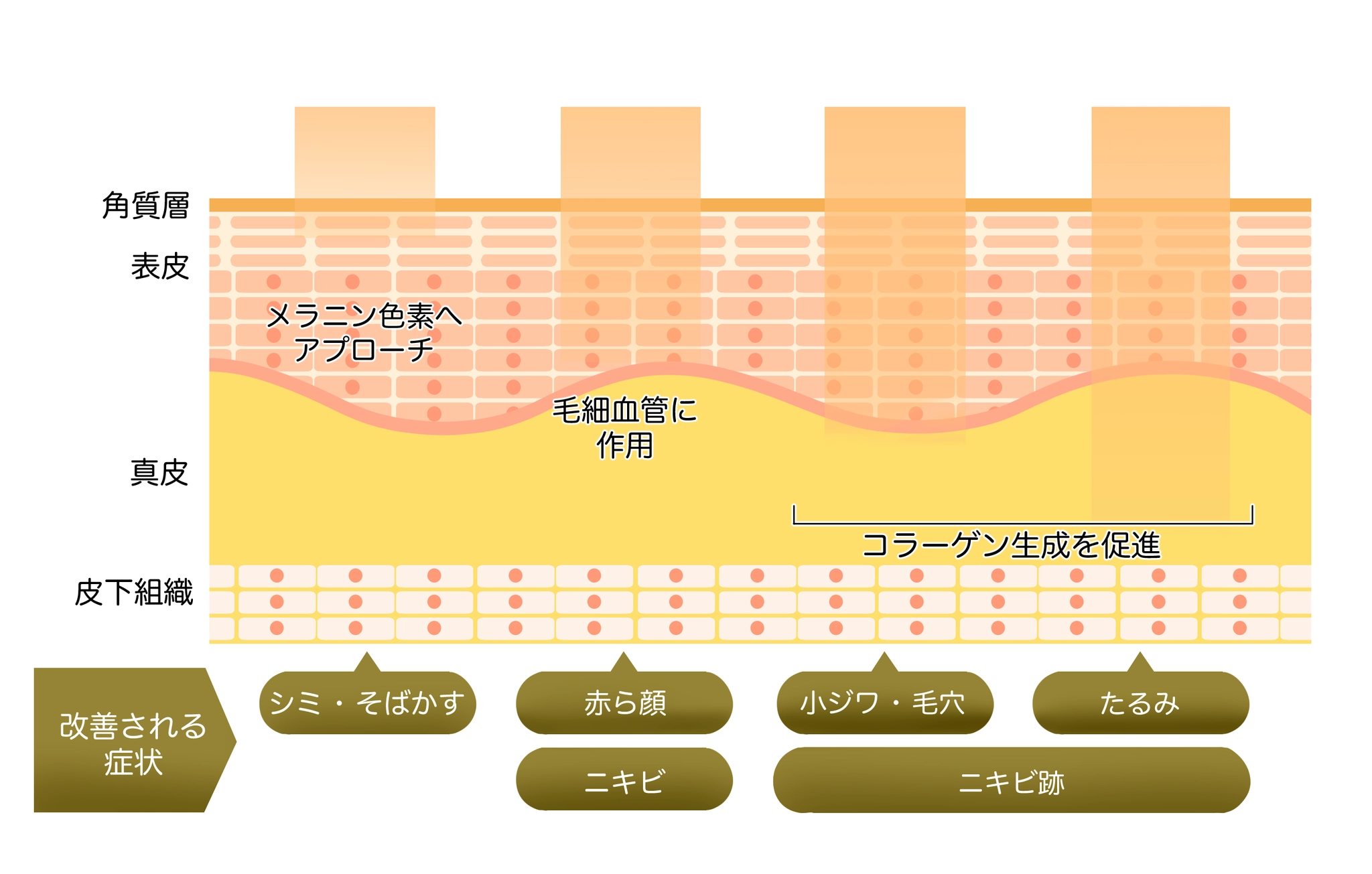IPLフェイシャルが肌の層へアプローチするイメージ図｜気になる肌印象へのはたらき