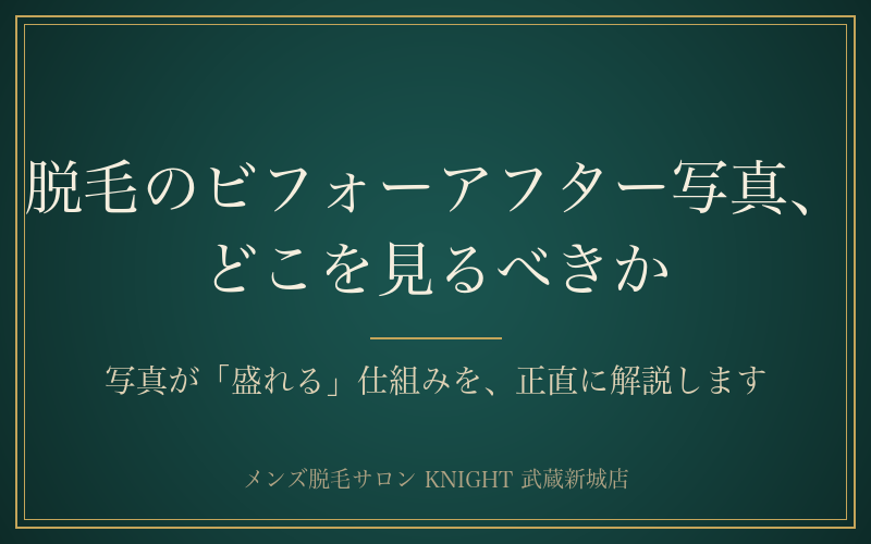 脱毛のビフォーアフター写真の正直な見方｜盛れる仕組み5つ｜KNIGHT武蔵新城店