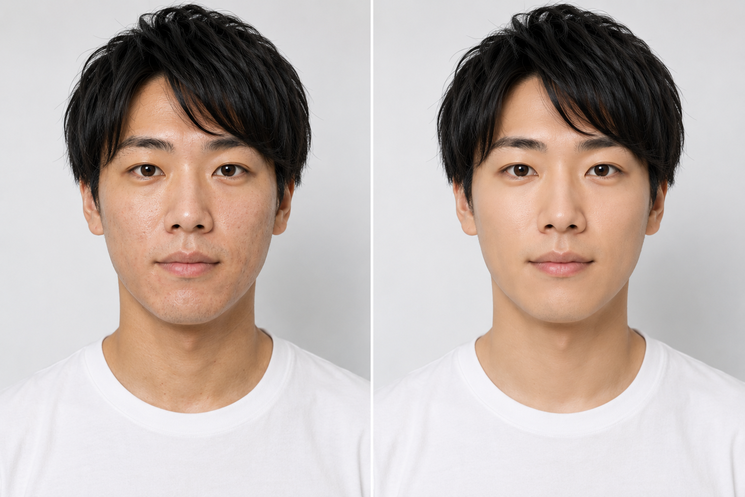 夏のテカリ・汗・毛穴が気になる男性へ｜脱毛×フェイシャルで整える清潔感対策｜KNIGHT武蔵新城店
